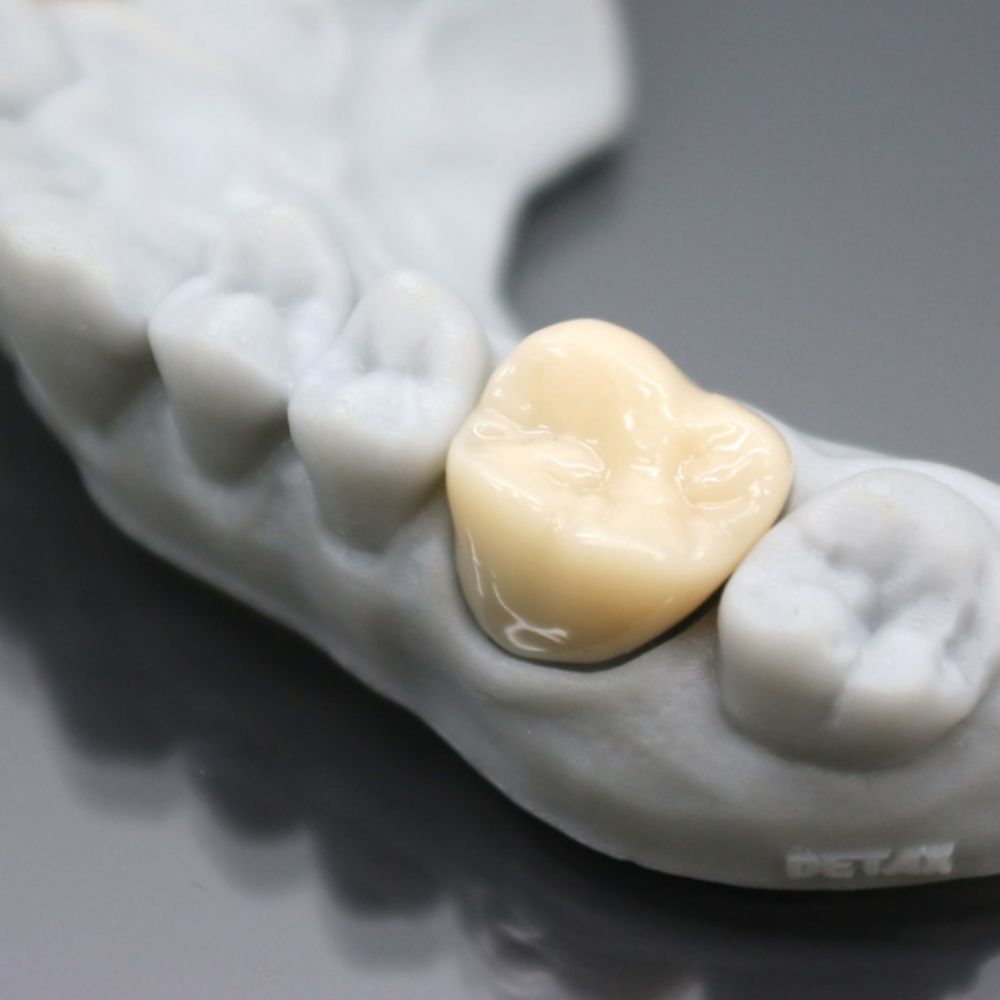 Detax - Freeprint Temp - Classe IIa - A1 - 500 g