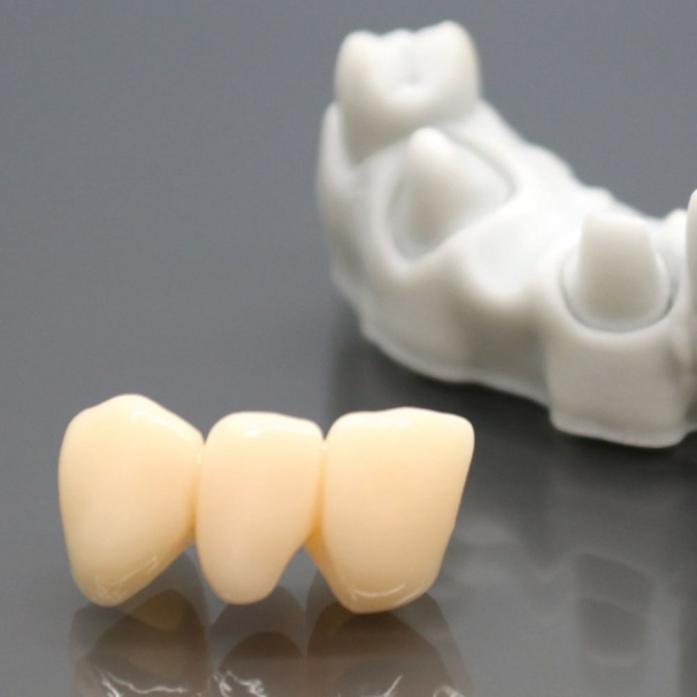 Detax - Freeprint Temp - Classe IIa - A1 - 500 g